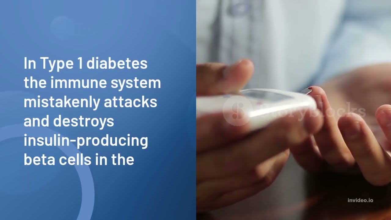 Glucofort – Leading Blood Sugar Support # IN THE WORLD