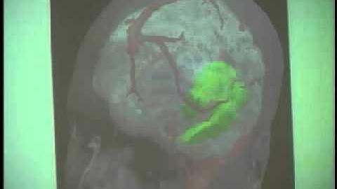 Lecture 4 - PDFs and Image Guided Surgery (Part 2/7)