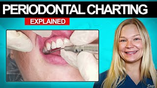 Periodontal Charting Explained | Hygienist Heather