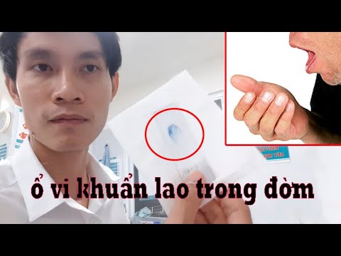 Video Kinh Hoàng Ổ Vi Khuẩn Lao Phổi Trong Đàm (Đờm) -... - YouTube