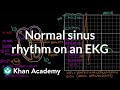 Normal sinus rhythm on an EKG | Circulatory System and Disease | NCLEX-RN | Khan Academy