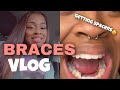 FINALLY GETTING BRACES! PAIN LEVEL AND GETTING USE TO THEM| VLOG