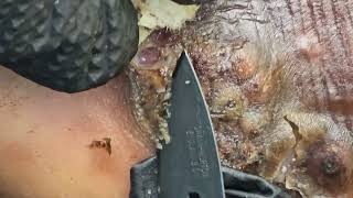 James Ngota's jigger digging - see long video @ riseupsociety.net & ruskenya.org