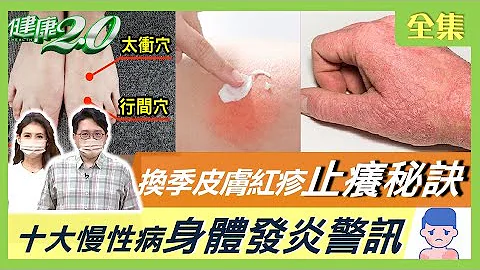 你過敏了嗎？換季皮膚紅疹止癢秘訣！十大慢性病 你身體發炎啦！養出不過敏體質 喝這杯排毒蔬果汁+中醫花茶！排毒好食上菜囉！健康2.0 20220305 (完整版) - 天天要聞