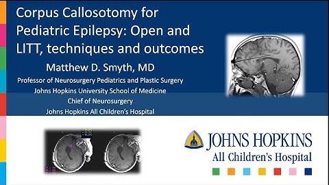 Dr Matthew Smyth. Corpus Callosotomy: Open & LITT techniques and outcomes