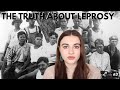 THE TRUTH ABOUT LEPROSY | A HISTORY SERIES