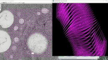 IMOD tutorial - Tomogram generation using Etomo patch tracking