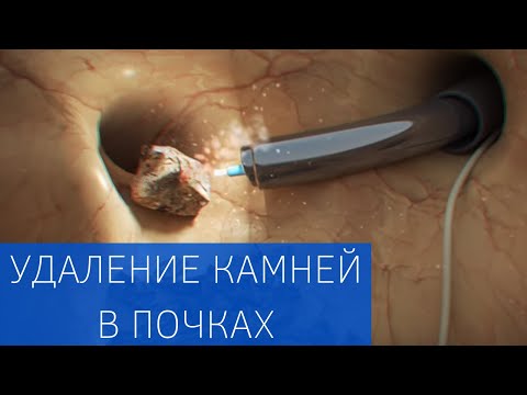 Вопрос: Как оперировать дробями?