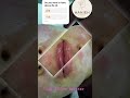 Lip filler booster hydration and rejuvenate #lipfiller #viral #shortvideo #drhanibeauty #dubai
