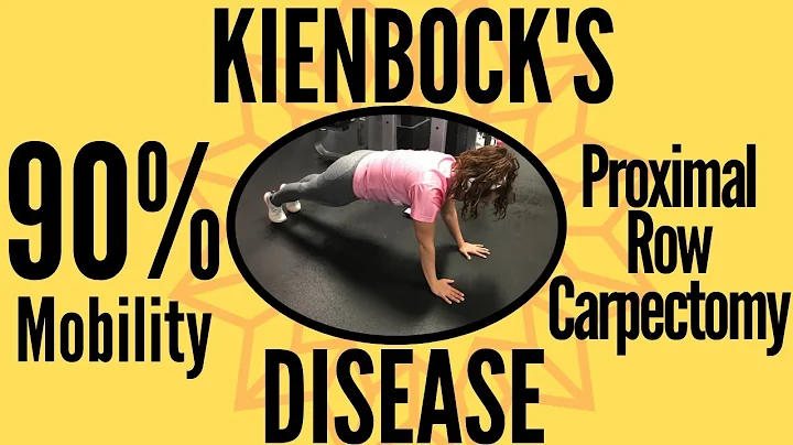 Kienbock's Disease: My PRC & Recovery (Motivational!)