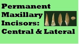 Permanent Maxillary Incisors