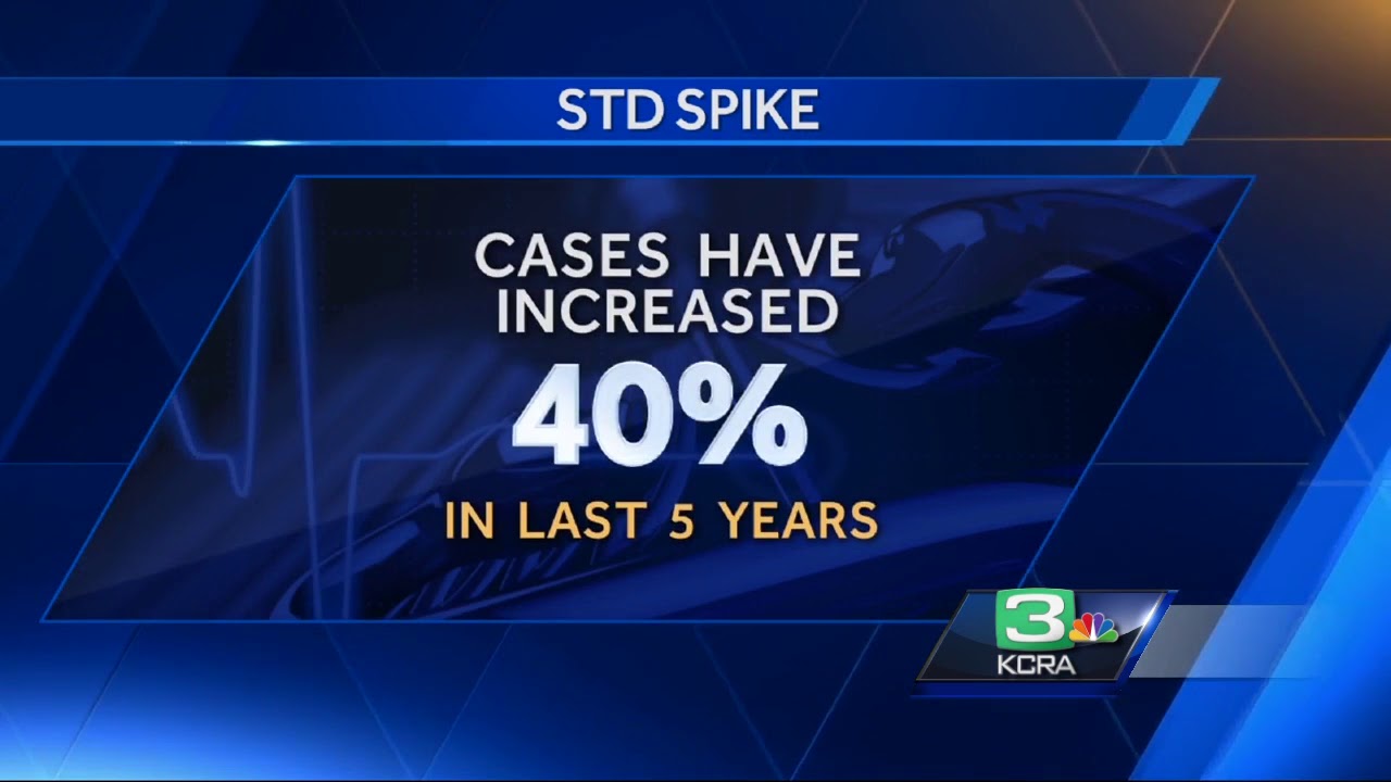 STD rates rise in Sacramento County, following statewide, nationwide trends