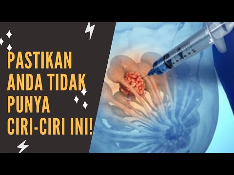 RESEP HIDUP SEHAT - WASPADA KANKER PAYUDARA!! DETEKSI SEDINI MUNGKIN!! - PART 2