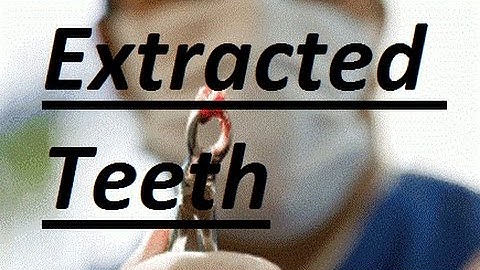 What Can Be Done If Teeth Are Already Extracted by Prof John Mew