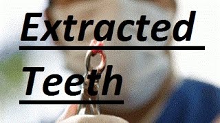 What Can Be Done If Teeth Are Already Extracted by Prof John Mew