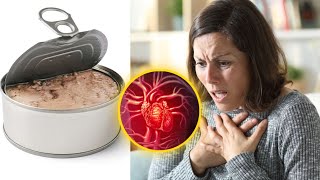 8 Superfoods That Has A Dark Side and We Shouldn’t Overeat