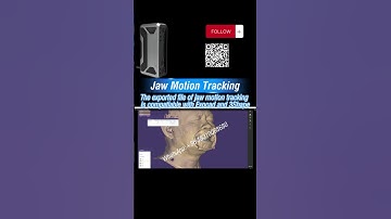 Jaw Motion Tracking with Facial 3D Scanner #thunk3d #digitaljawmotion #jawmotiontracking #facialscan