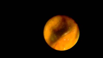 OD0.8mm Flexible Fiber Scope-Test Video / OD0.8mm 軟管纖維鏡-測試影片