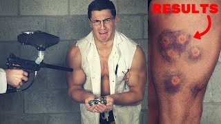 Shot with MARBLES from a Paintball Gun *EXTREME BRUISING* | Painful Slow Motion Guns Experiment