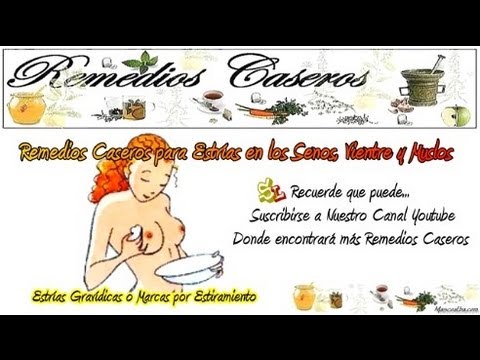 Remedios Caseros para Reducir las Estrías de los Senos, Quitar las Estrías  del Vientre y Muslos - YouTube