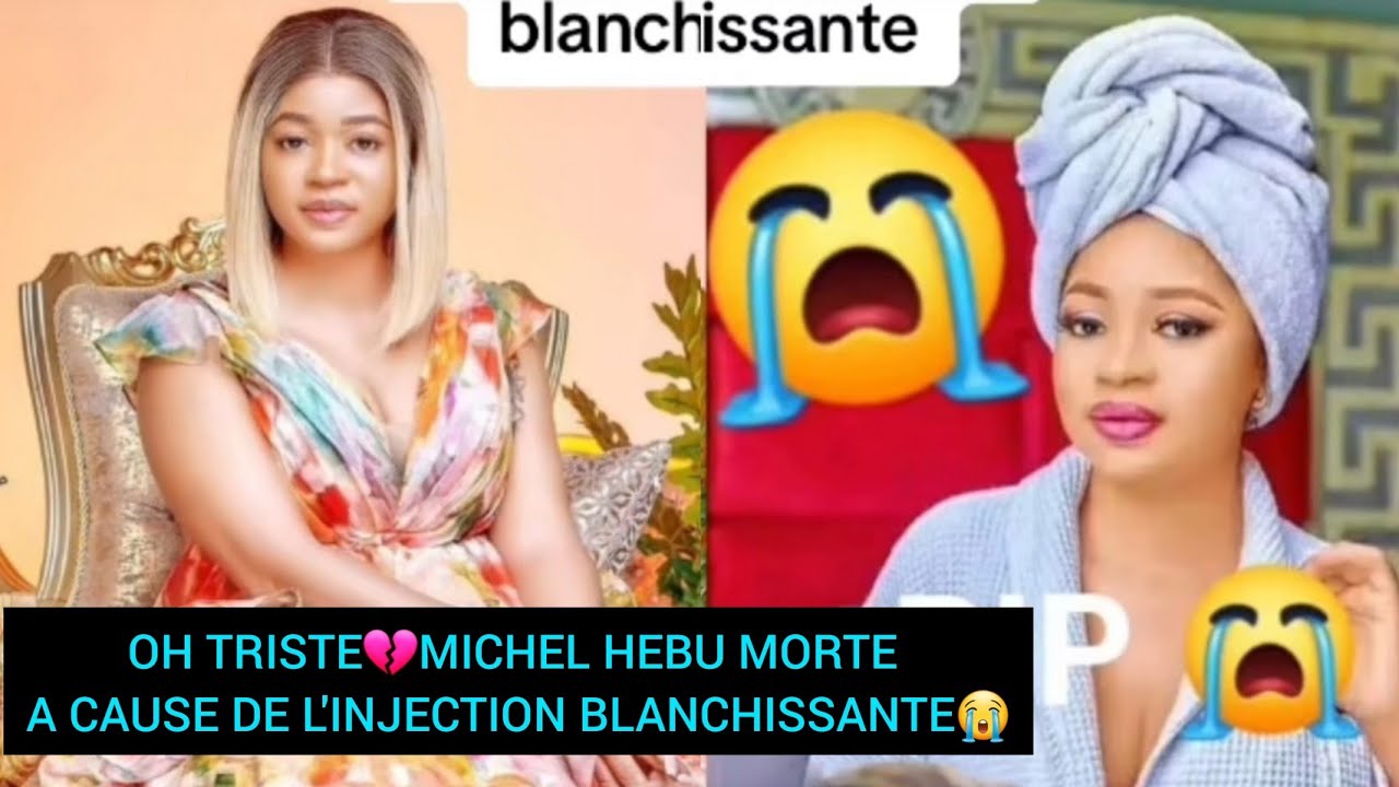 OH😭TRISTE😭MICHEL HEBU INFLUENCEUSE MORTE A CAUSE DE L'INJECTION BLANCHISSANTE😭