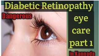 Diabetic Retinopathy Eye care information /#complete details about Diabetic Retinopathy in Kannada