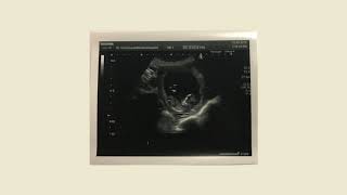 Danny Thomas - I Swear About To Be A Dad