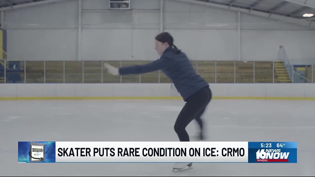 Medical Moment: Chronic recurrent multifocal osteomyelitis