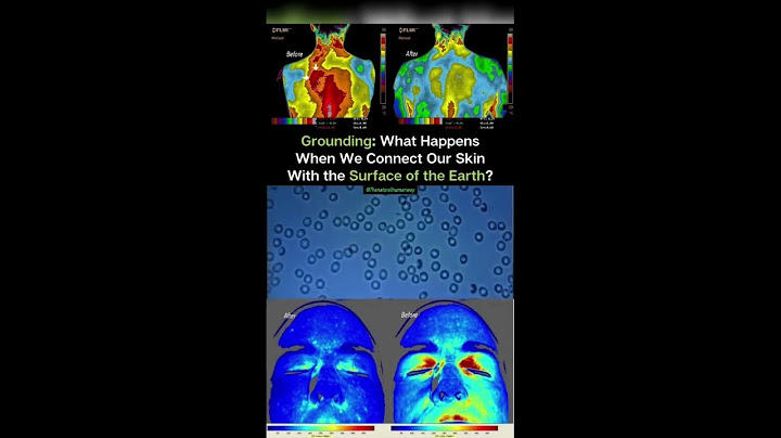 Grounding : What Happens When We Connect Our Skin With the Surface of the Earth