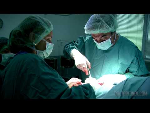 Видео: Хирургия за намаляване на челото: процедура, цена, други опции
