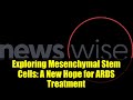 Exploring Mesenchymal Stem Cells: A New Hope for ARDS Treatment