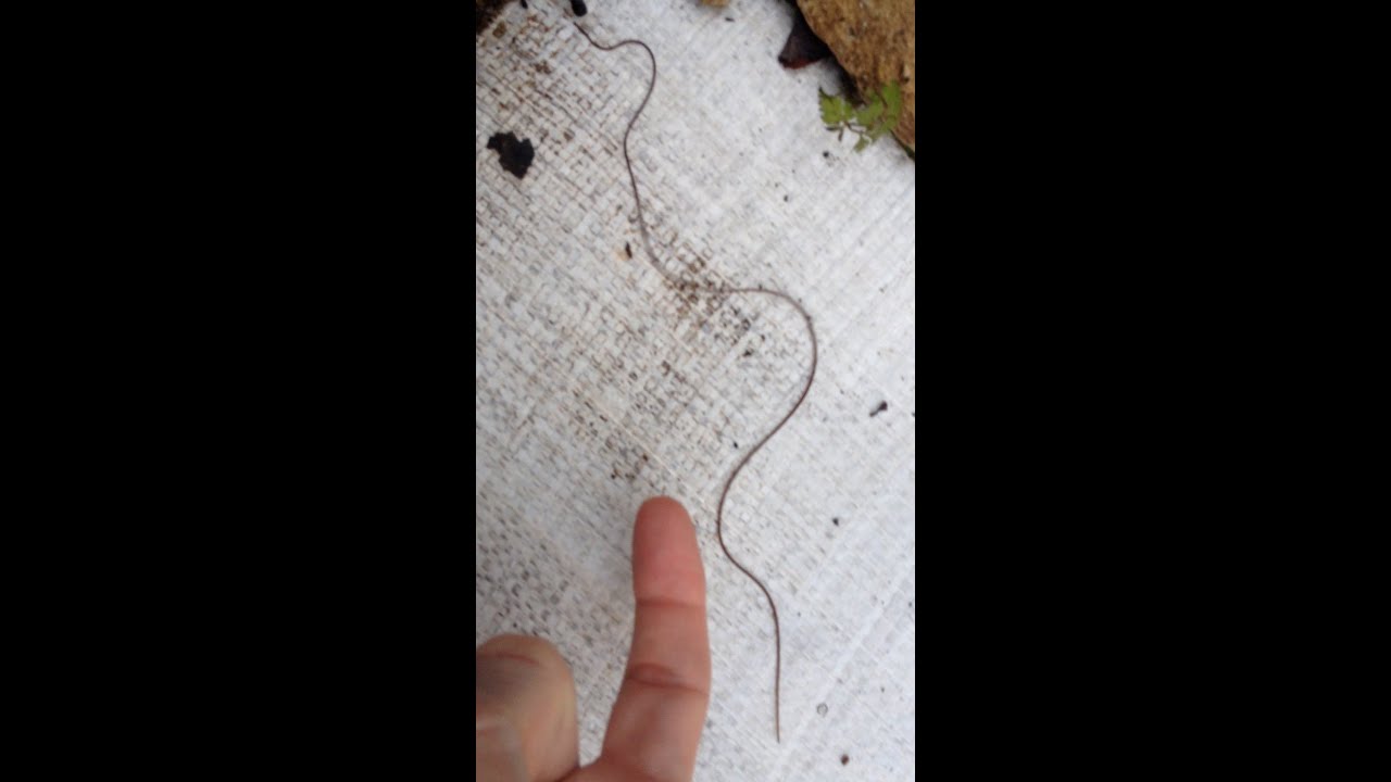 Black Lines Under Finger Nail - Horsehair Nematomorpha Parasite -  Morgellons - Thread - Hook Worm - YouTube