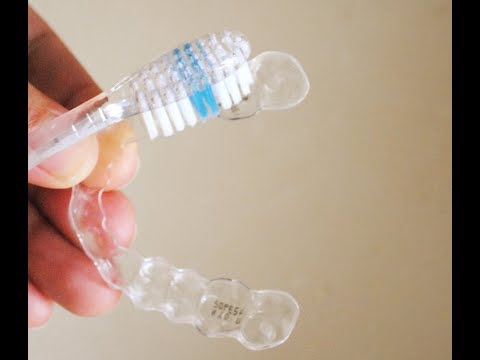 Invisalign Αόρατοι Νάρθηκες Δοντιών - Πώς να τα συντηρείτε