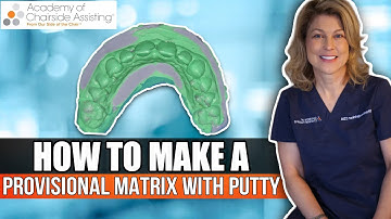 How to Use a Putty Matrix | Provisional & Esthetic Techniques