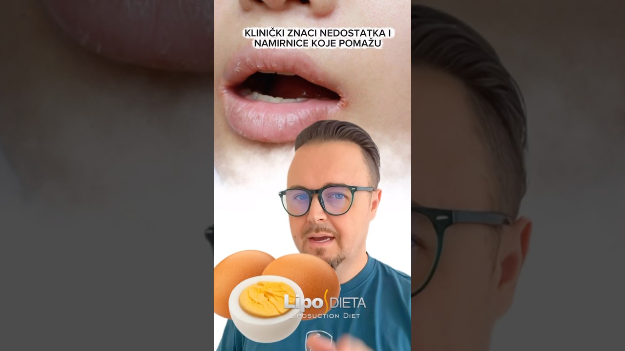 Klinički znaci nedostataka i namirnice koje pomažu!