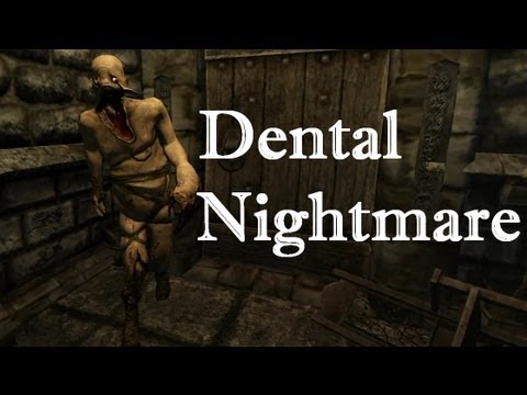 阿津實況 失憶症 牙醫惡夢 Amnesia Dental Nightmare