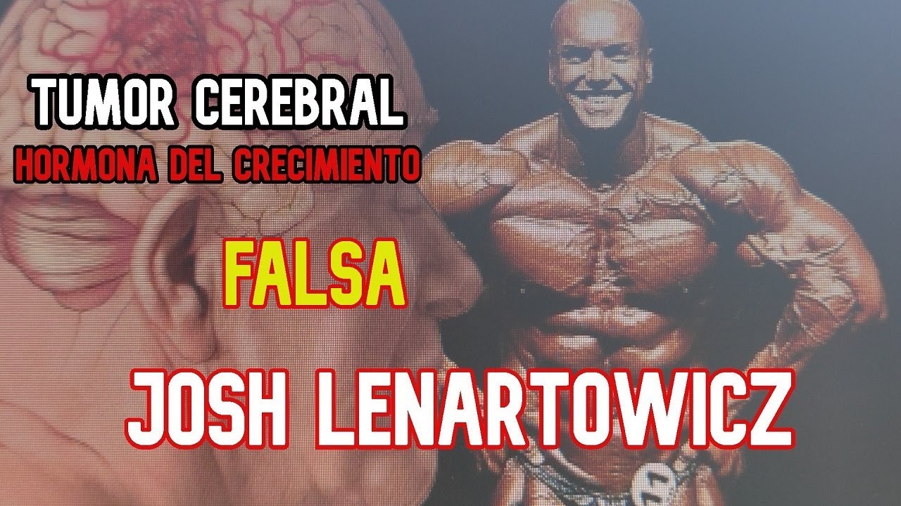 JOSH LENARTOWICZ Y SU TUMOR CEREBRAL