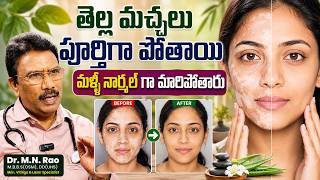 తెల్ల మచ్చలు పూర్తిగా పోతాయి.. | Tellamachalu Solution | Dr. MN. Rao About 😱 Vitiligo Treatment