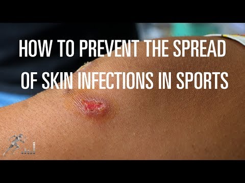 How to avoid skin infections in sports