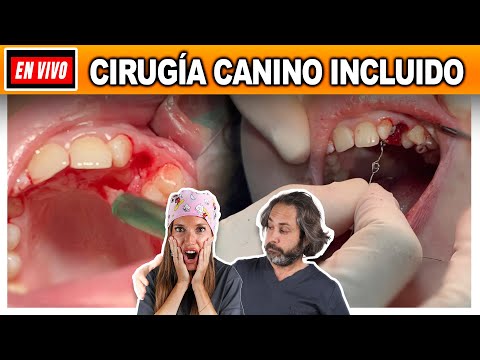 Vídeo: La cirurgia canina impactada fa mal?