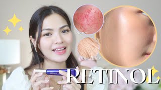 BEST SKINCARE INGREDIENT?? HOW TO USE RETINOL ✔+ WHAT TO AVOID ❌• Joselle Alandy