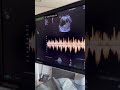 Hearing babies heartbeat for the first time 11 weeks pregnant