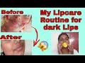 How to get rid of dark lips in 3days || get pink lips in just 1week || dark lips lipcare routine