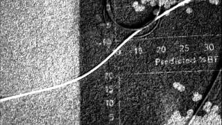 Download Lagu Lapcat - Adelaia MP3