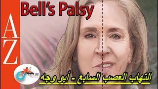 Bell palsy |From A to Z | التهاب العصب السابع  | الاعراض والعلاجات| ابو وجه| كل اربعاء