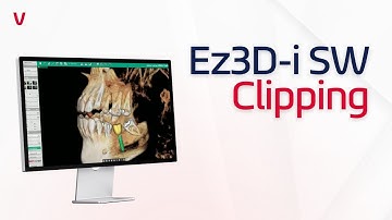 Ez3D-i SW | Clipping