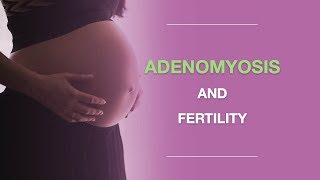 Adenomyosis and Fertility: What You Should Know About Adenomyosis And Pregnancy