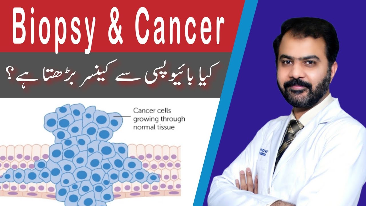 Biopsy aor Cancer, kya biopsy cancer ka bais bnti ha? - YouTube