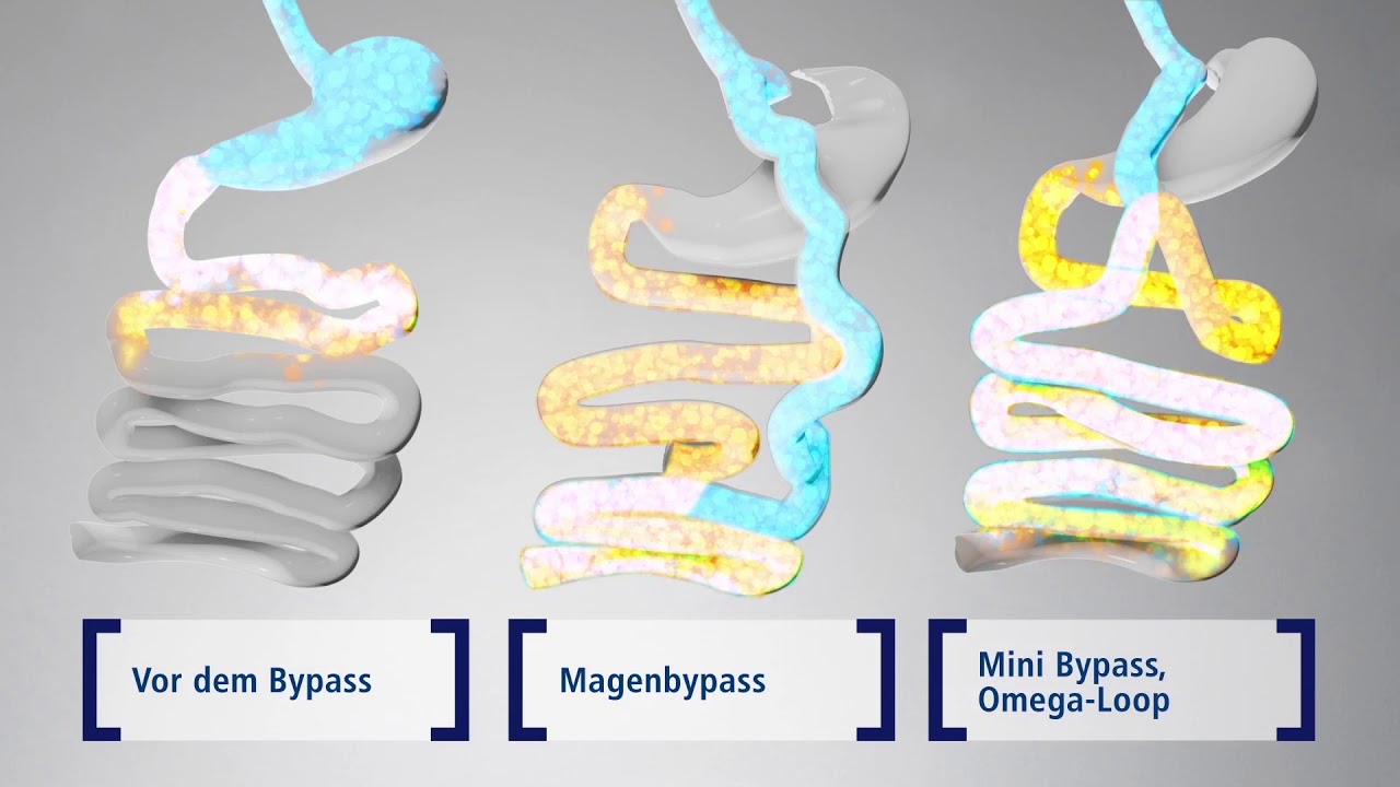 Omega Loop Bypass YouTube