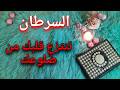 استخارة عامة تفصيلية بالقرآن الكريم لمواليد برج السرطان 